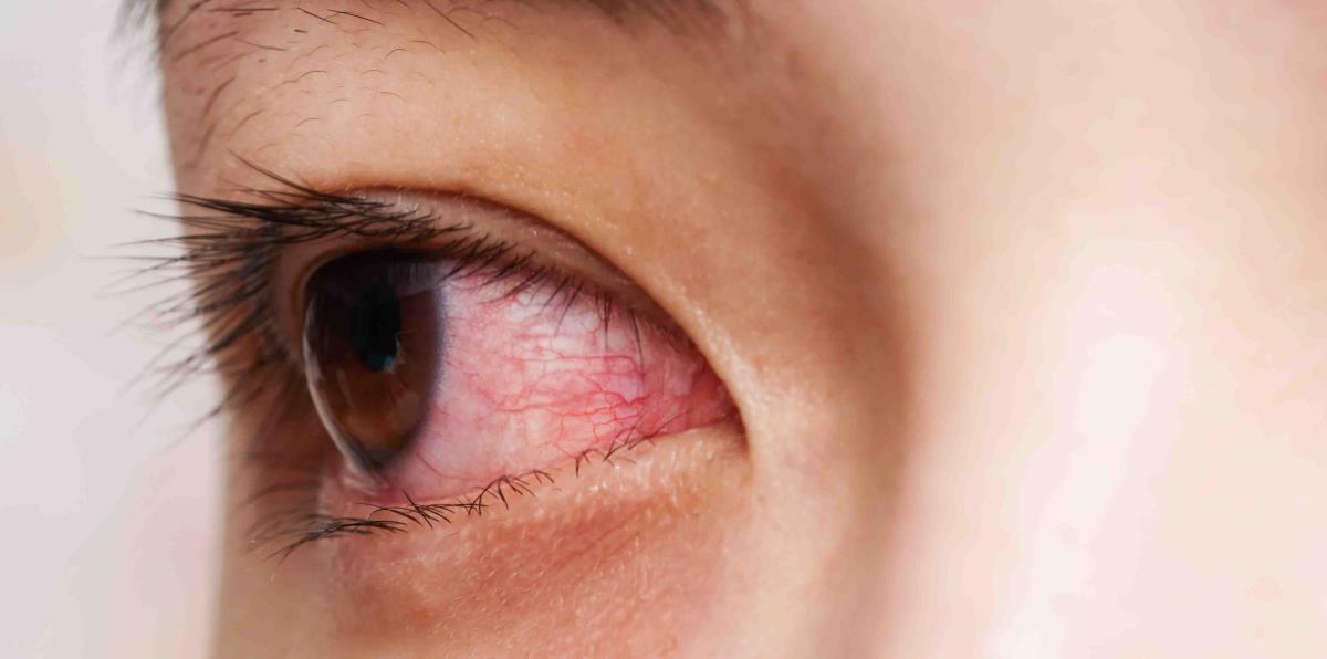 Qué Bonitos Ojos Tienes En Inglés