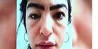 Ojo con el microblading Ojo con el microblading